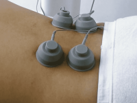 ems cupping